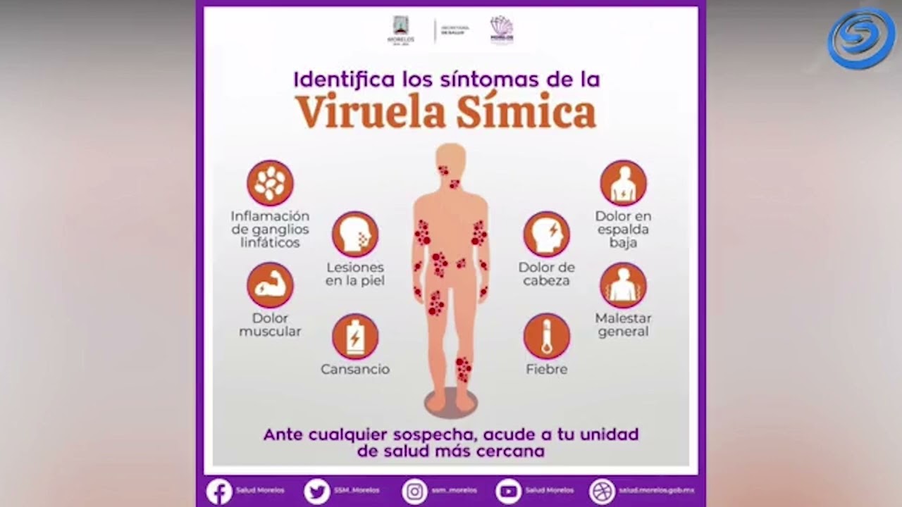 CONFIRMAN SEGUNDO CASO DE VIRUELA DEL MONO EN EL ESTADO