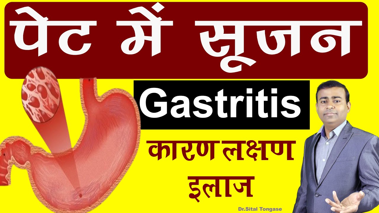 Inflammation of the stomach: Gastritis: Causes, Symptoms and Treatment. Gastritis in Hindi