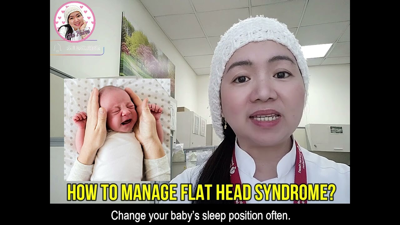 Flat head syndrome