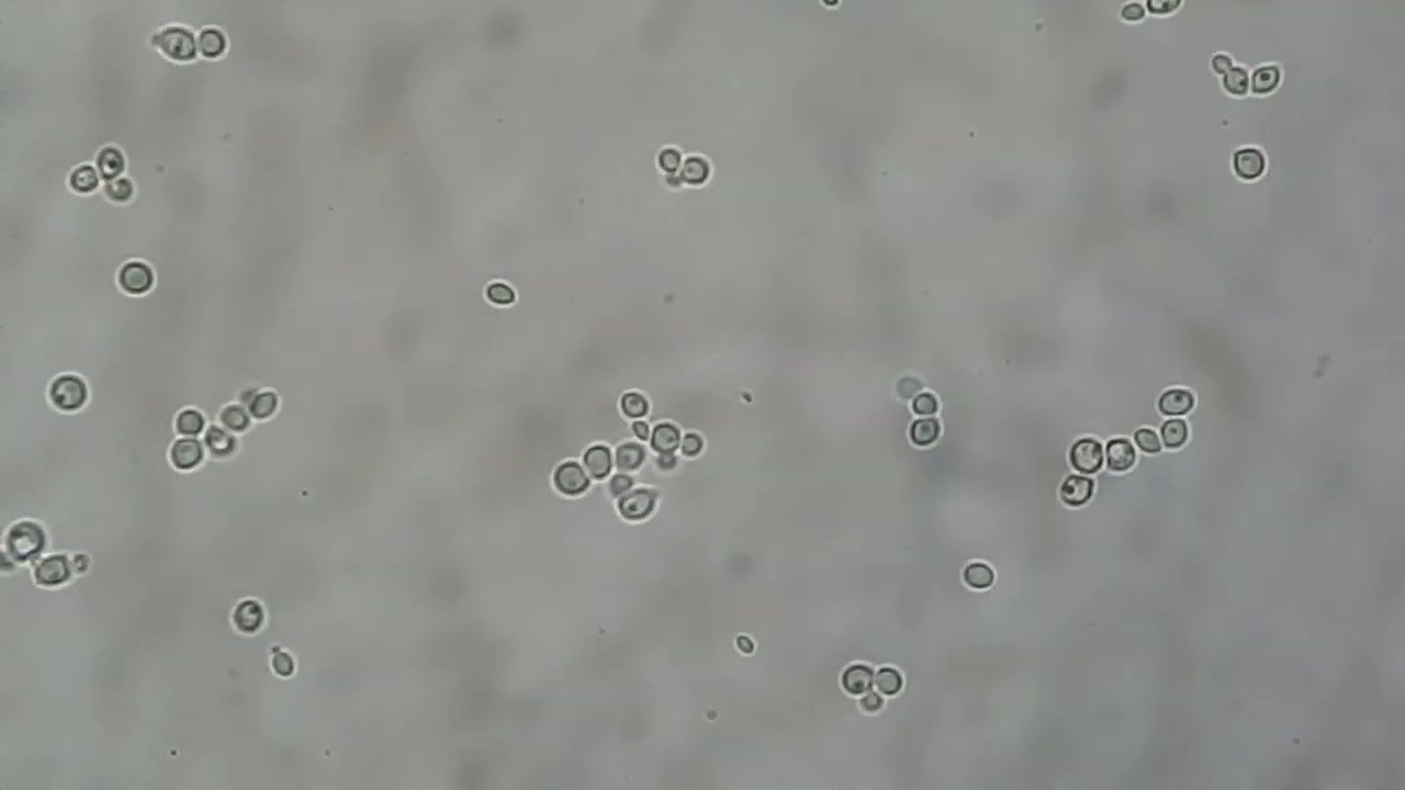 Germ tube test of Candida negative and positive