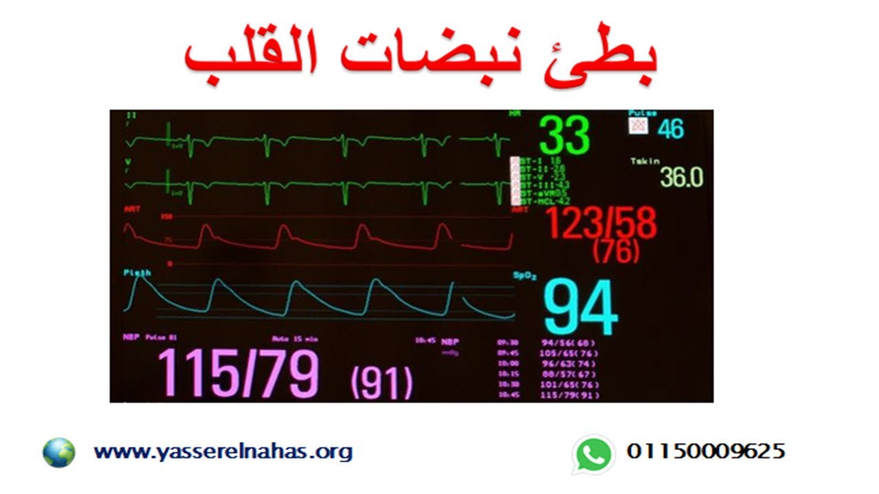 بطء القلب - بطئ نبضات القلب - أسباب و عوامل الخطر و علاج ضربات القلب البطيئة