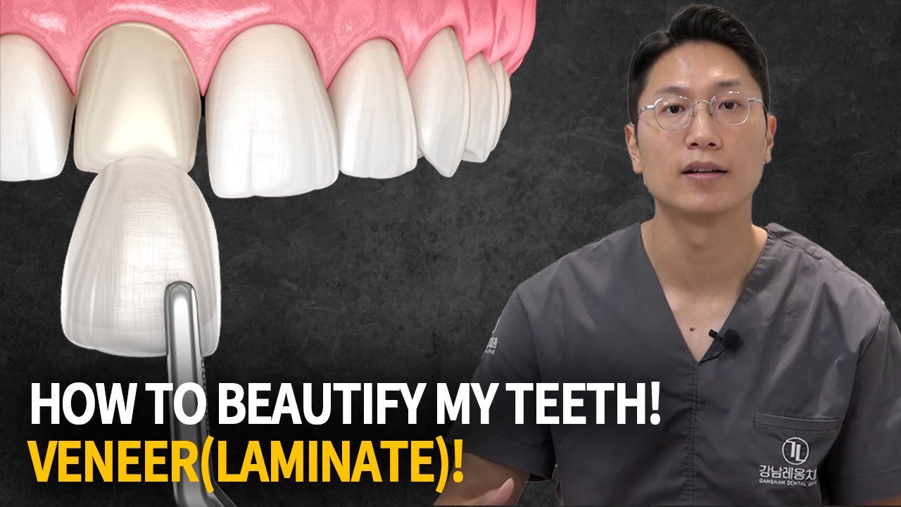 Make your teeth more beautiful! | Everything about the Veneer!