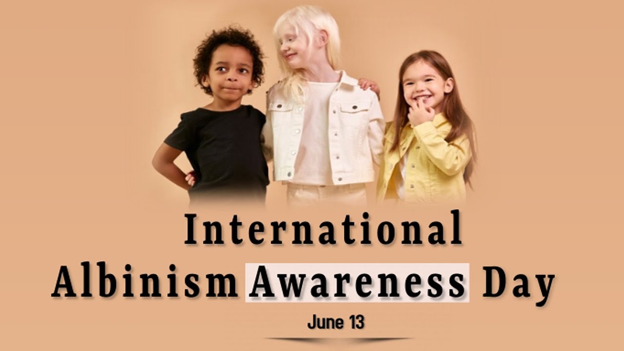 International Albinism Awareness Day | 13th June | ASFE World TV