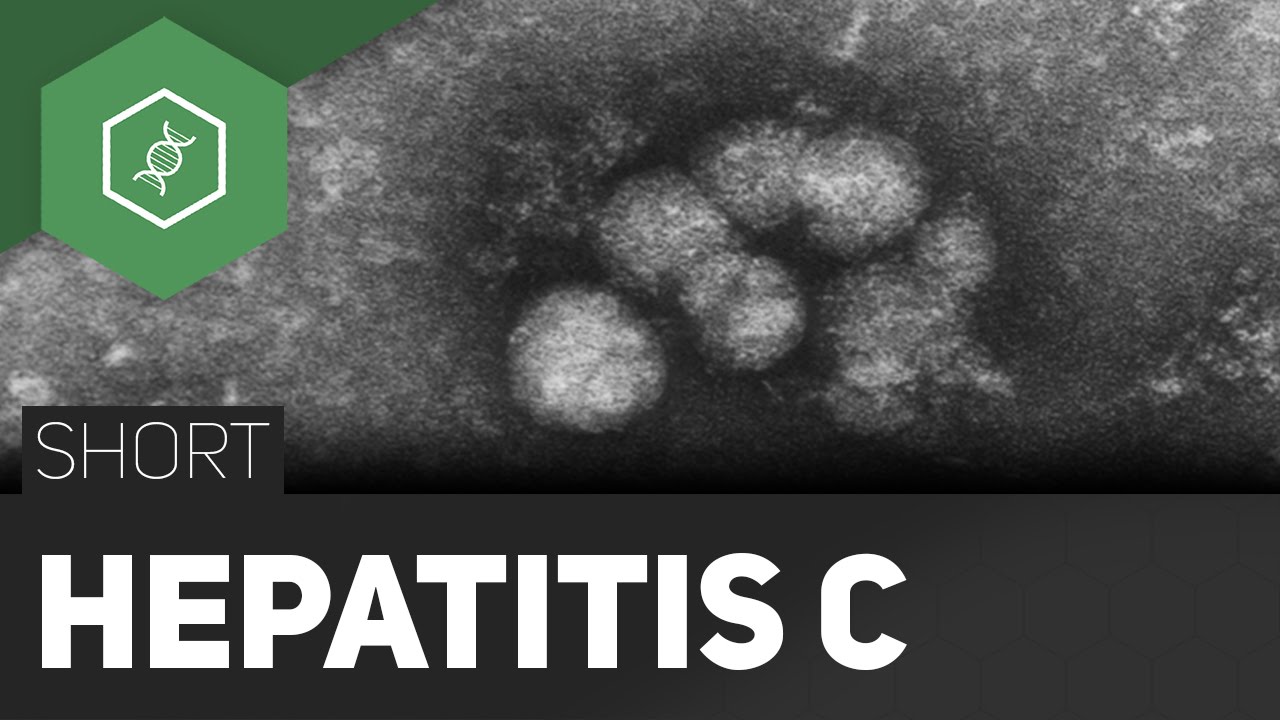 Hepatitis C – Vernarbung der Leber?!