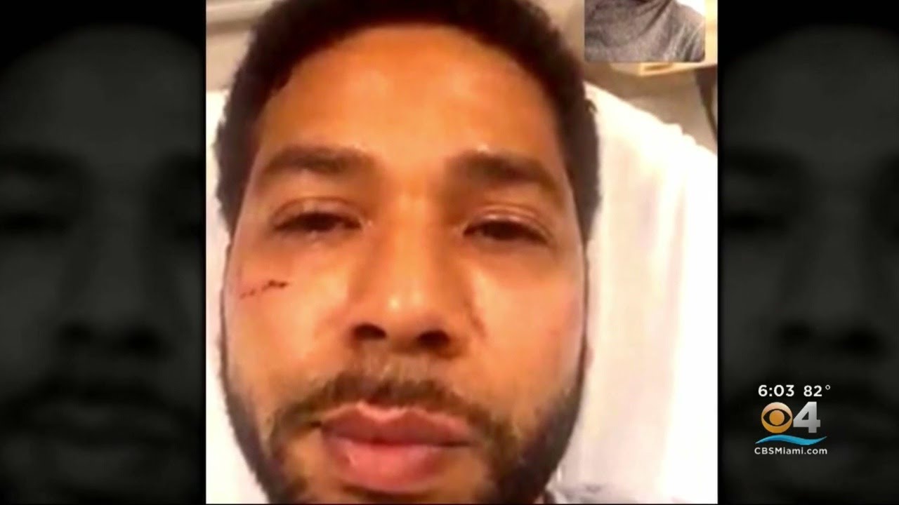 Jussie Smollett Charges Dropped