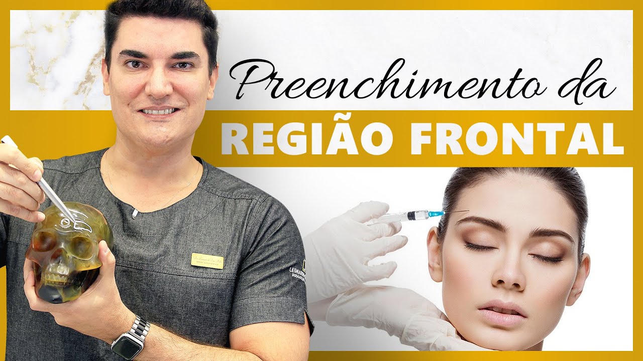 Harmonização Facial através do Preenchimento da Região Frontal com Ácido Hialurônico
