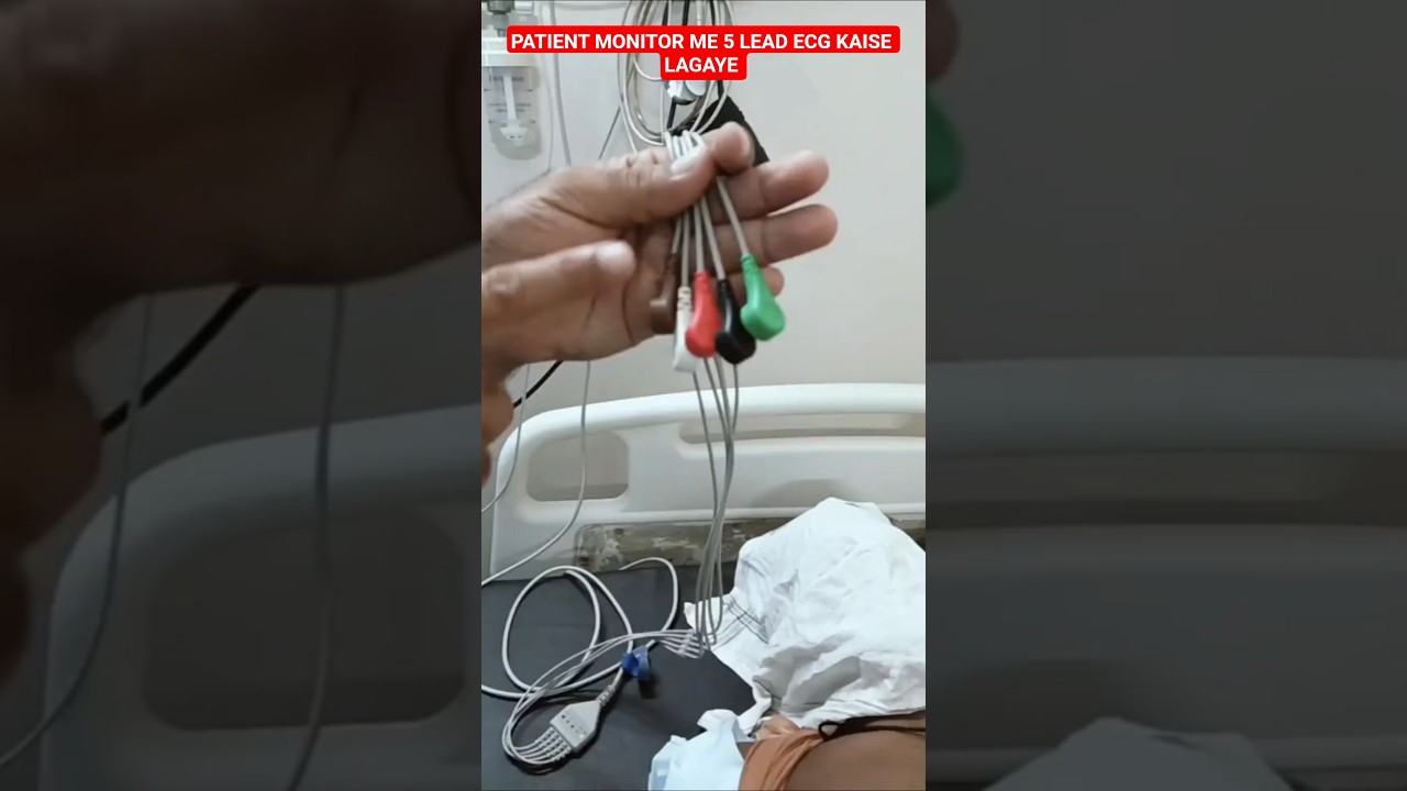PATIENT MONITOR ME 5 LEAD ECG KAISE LAGAYE#hospital#doctor#shortvideos#viral#trending#shorts#yt#ecg.