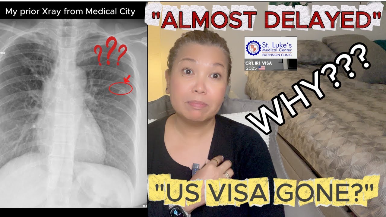 US VISA ALMOST DELAYED DUE TO XRAY ISSUES...WHY???