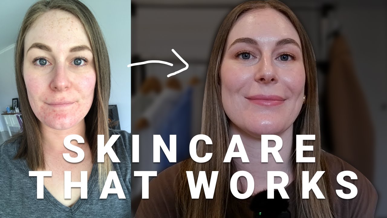 How I Finally Got Glowing Skin (Tips That Actually Work)