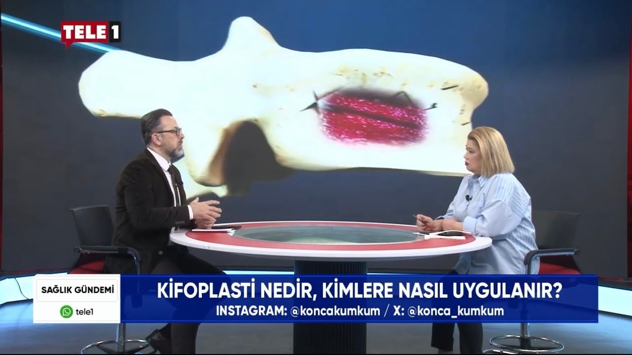 Omurga Çökme Kırıklarında Yeni Dönem:Kifoplasti Kimlere Uygulanır? #kifoplasti #vertebroplasti #pain