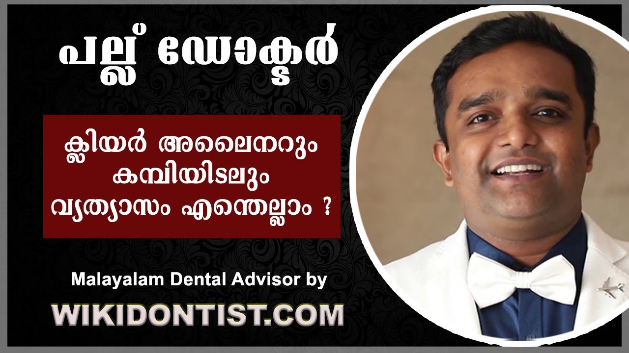 ക്ലിയർ അലൈനറും കമ്പിയിടലും വ്യത്യാസം എന്തെല്ലാം? ( Malayalam) clear aligners/ Invisalign Vs braces