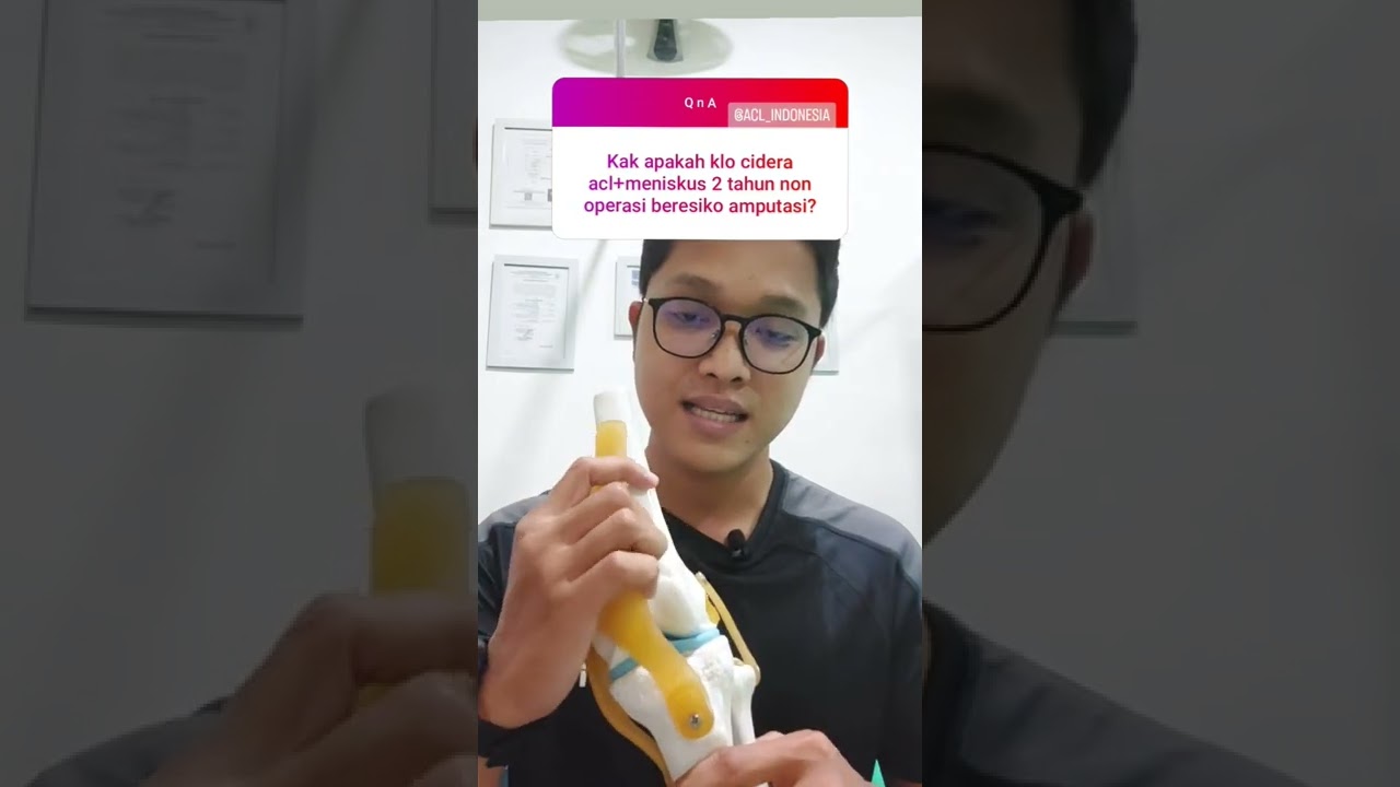 apa yang terjadi ketika ACL dan Meniskus kita cidera tapi ga operasi? #aclreconstruction #acl
