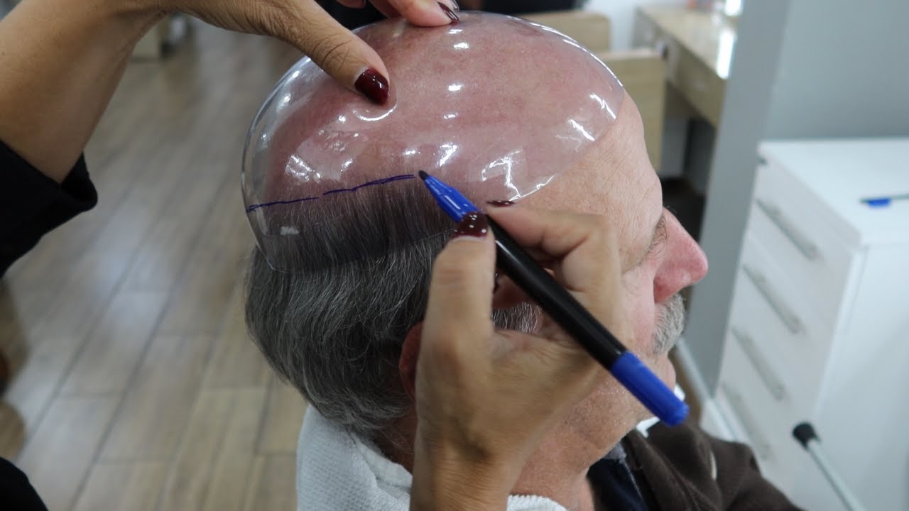 PASSO A PASSO DA APLICAÇÃO PRÓTESE CAPILAR MASCULINA ADESIVA