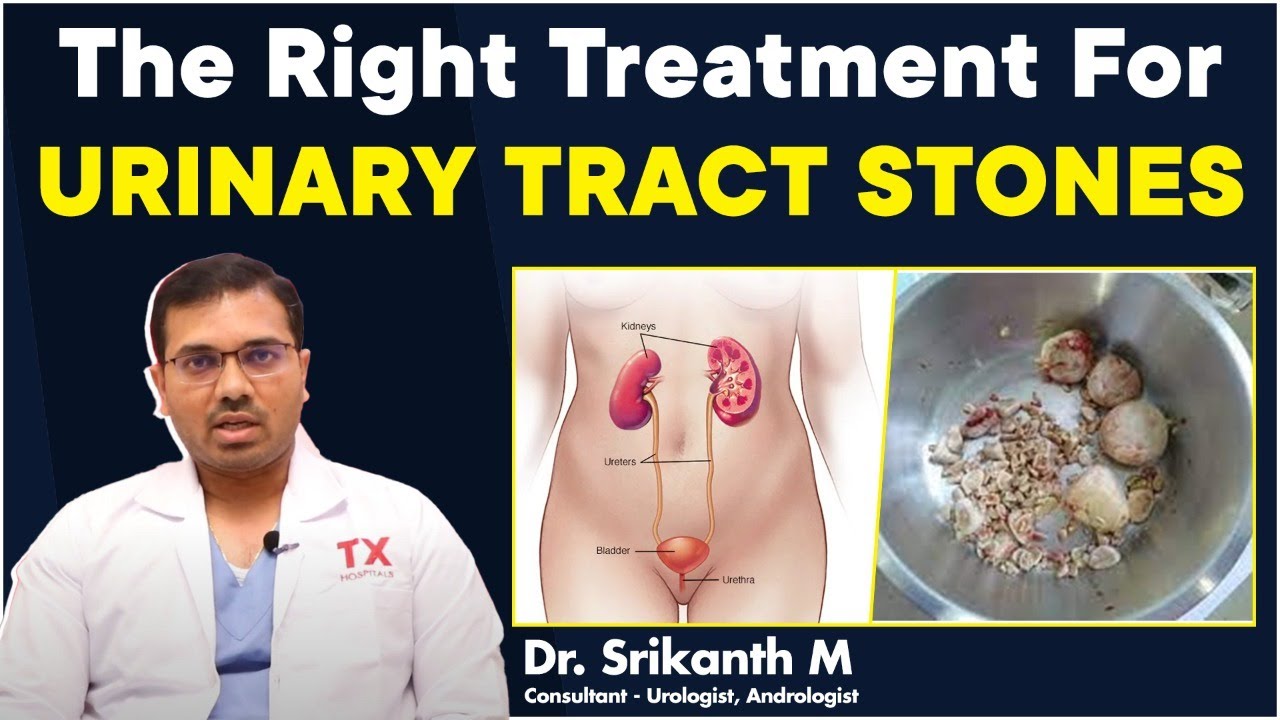 Urinary Stones - Causes, Symptoms || Urinary Bladder Stones Treatment || Dr Srikanth || TX Hospitals