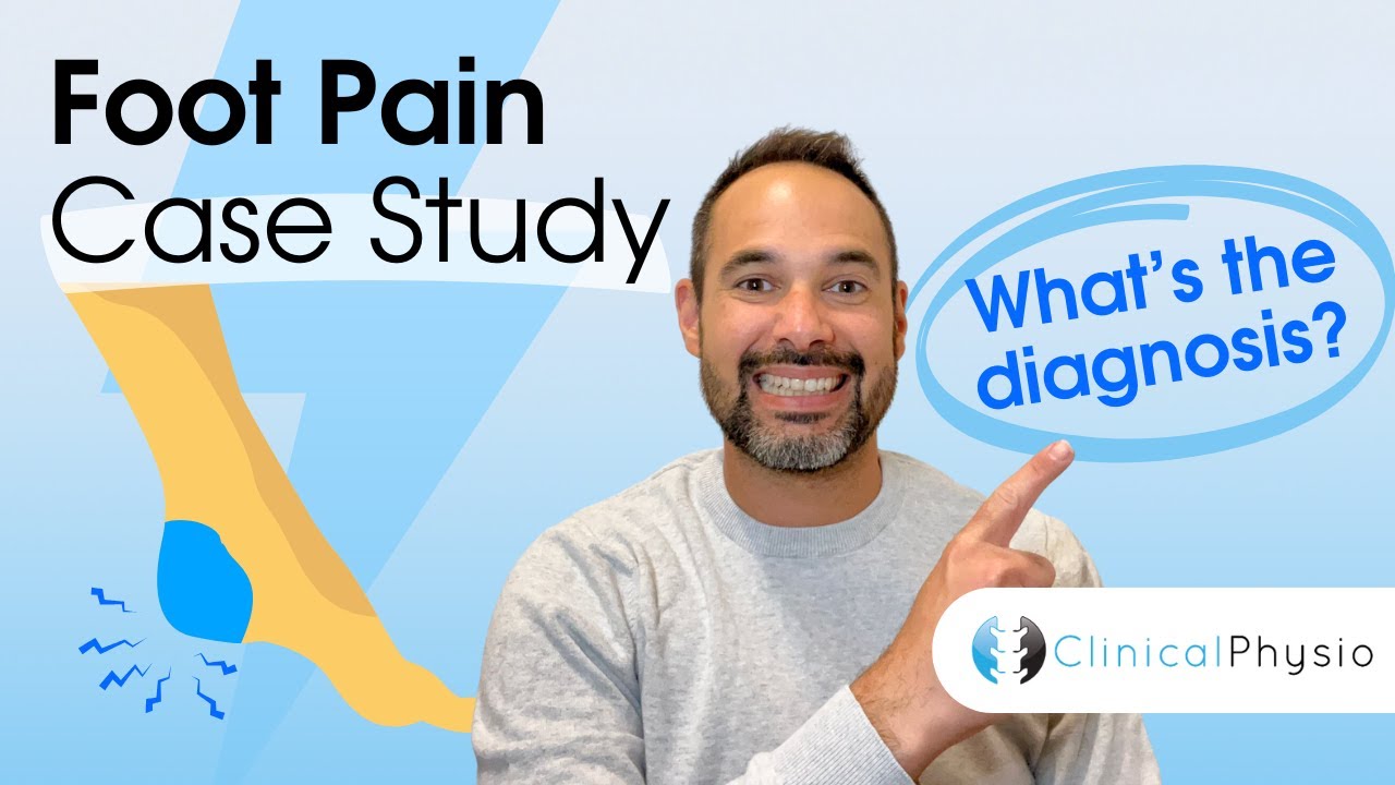 Foot Pain Case Study | Expert Physio explains Key Details for Interesting Patient Case!