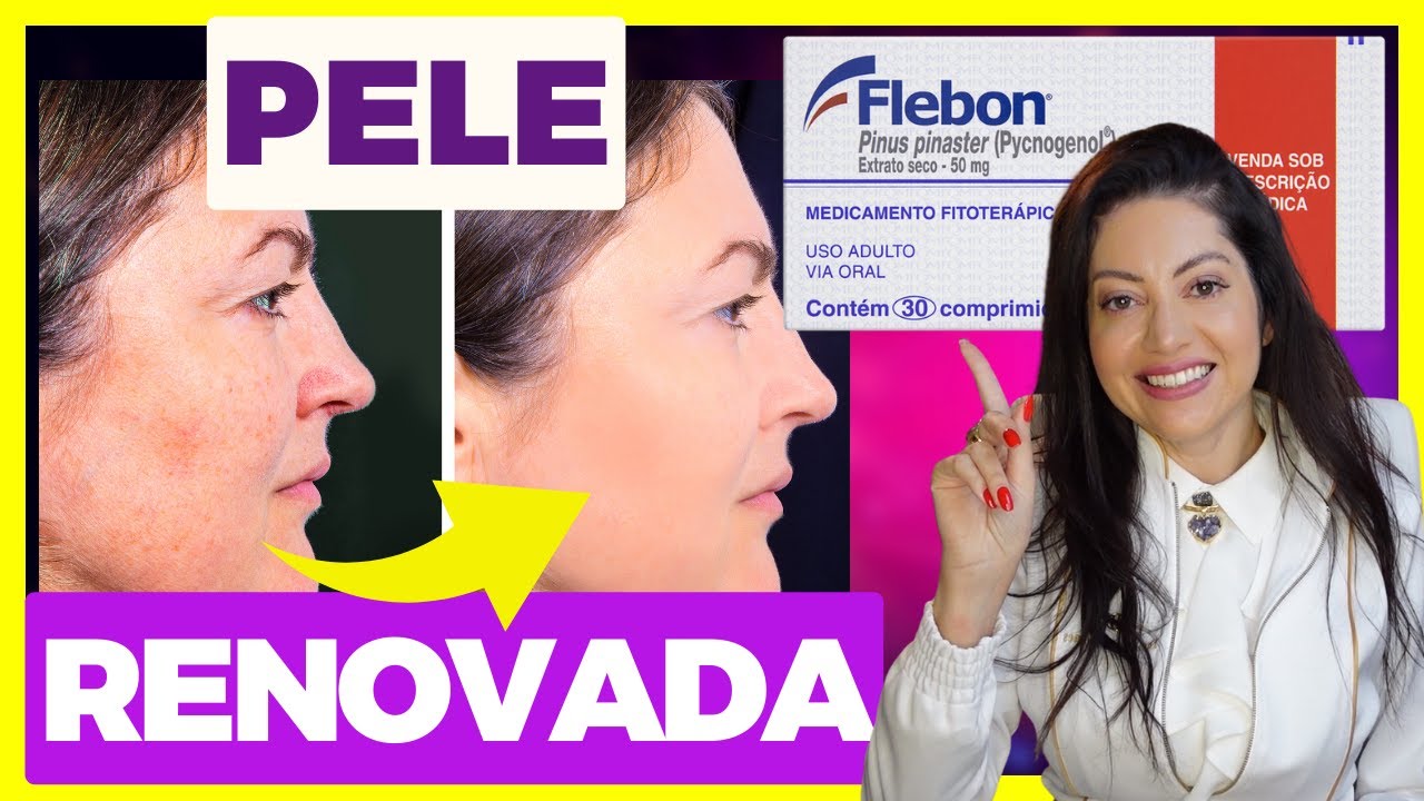 PICNOGENOL: RUGAS, MANCHAS e MELASMAS. Como Usar Picnogenol para CLAREAR MANCHAS DA PELE e MELASMAS