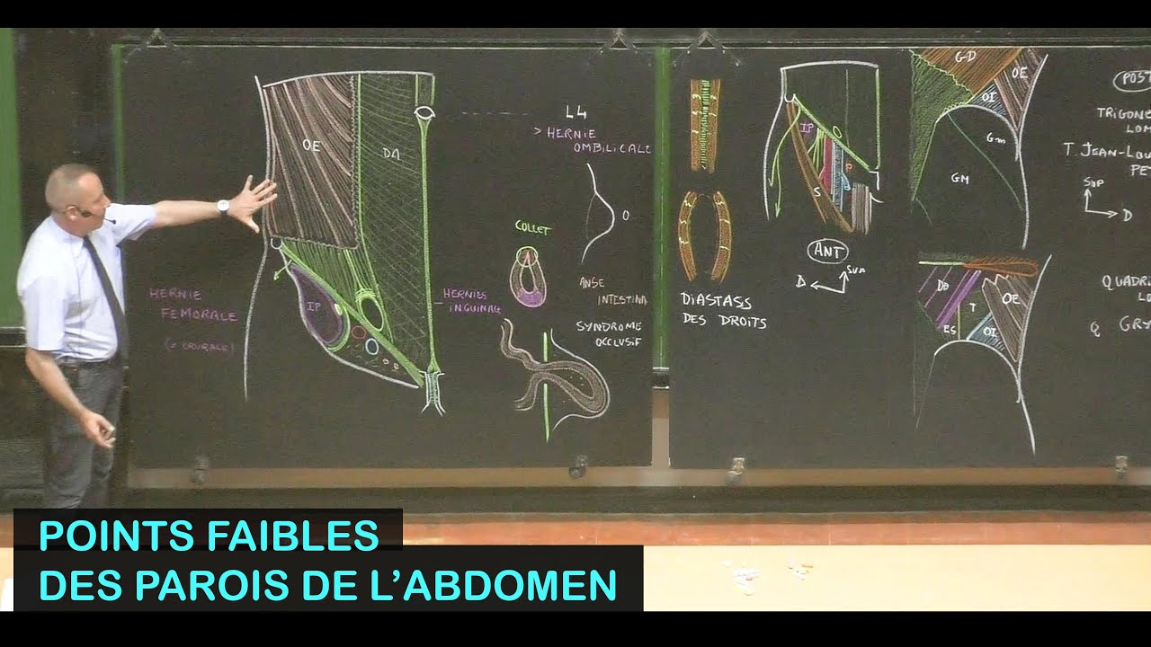 Anatomie des points faibles des parois de l'abdomen (Parois de l'abdomen 3)