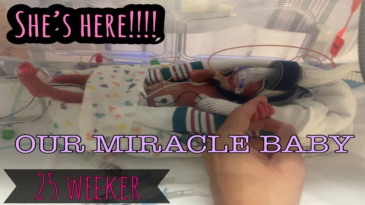 25 WEEKER|GIVING BIRTH AT 25 WEEKS|BABY GIRL IS HERE EARLIER THAN EXPECTED|MICROPREEMIE|OUR MIRACLE