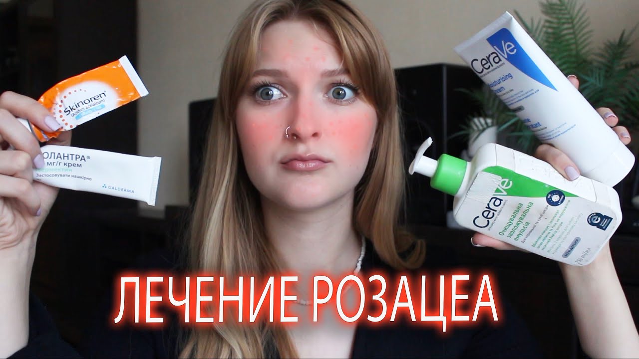 РОЗАЦЕА И УГРИ/ Мой уход Cerave/ Высипания и акне при розацеа
