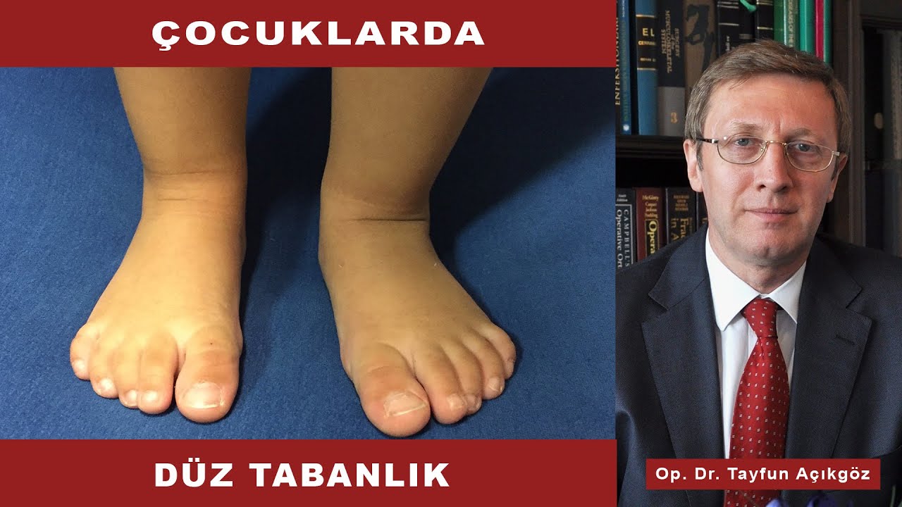 Çocuklarda Düz Tabanlık - Op. Dr. Tayfun Açıkgöz