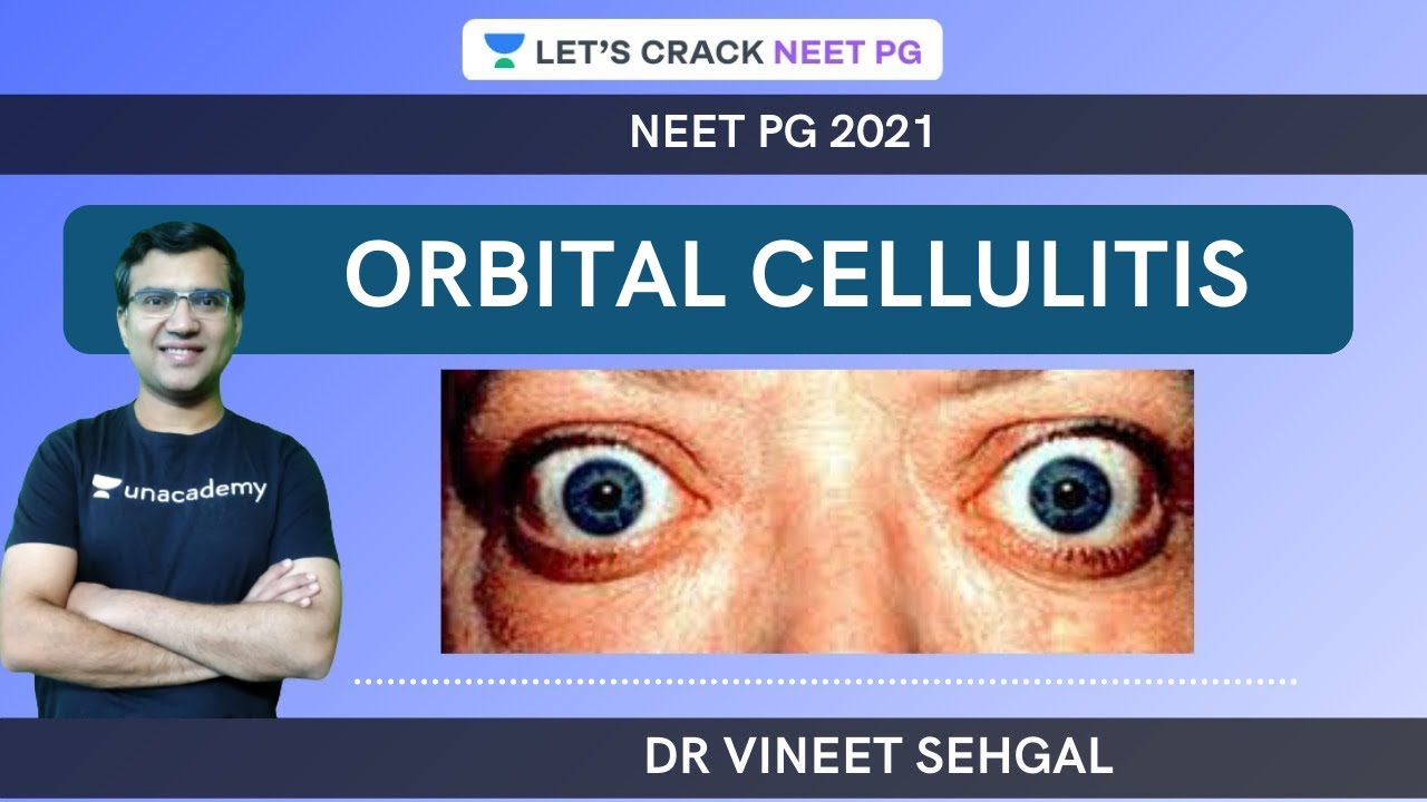 Orbital Cellulitis |  NEET-PG 2021 | Vineet Sehgal