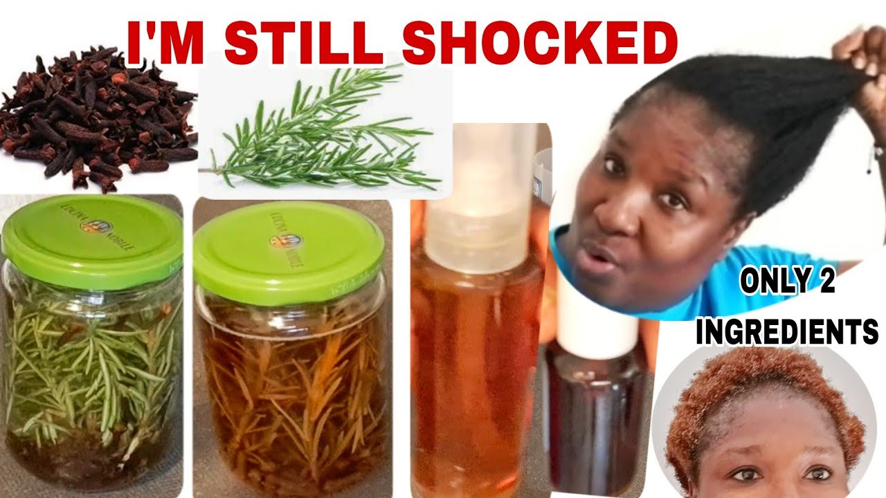 I'M STILL SHOCKED!!! I USED CLOVE & ROSEMARY WATER ON MY HAIR EVERYDAY FOR 7DAYS & THIS HAPPENED