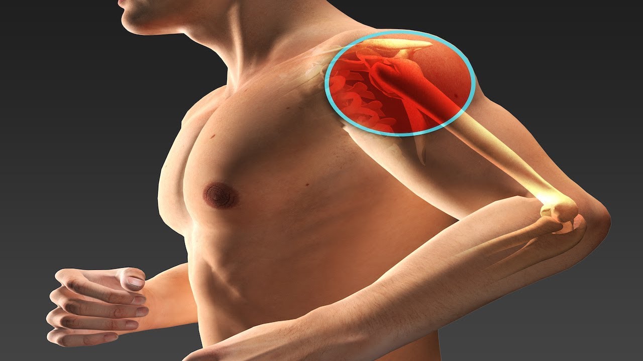 What are Shoulder Labrum Tears and How Are They Treated? | Dr. Walter Stanwood