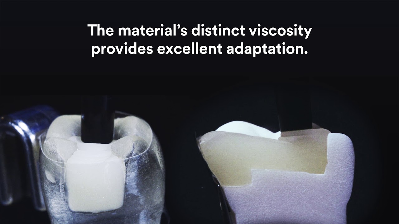 3M Filtek One Bulk Fill Restorative Adaptation Demonstration