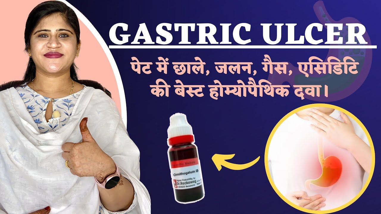 Gastric ulcer : पेट में छाले, जलन, बदहज़्मी की बेस्ट दवा | Peptic ulcer Treatment | Dr. Arwa Bohra