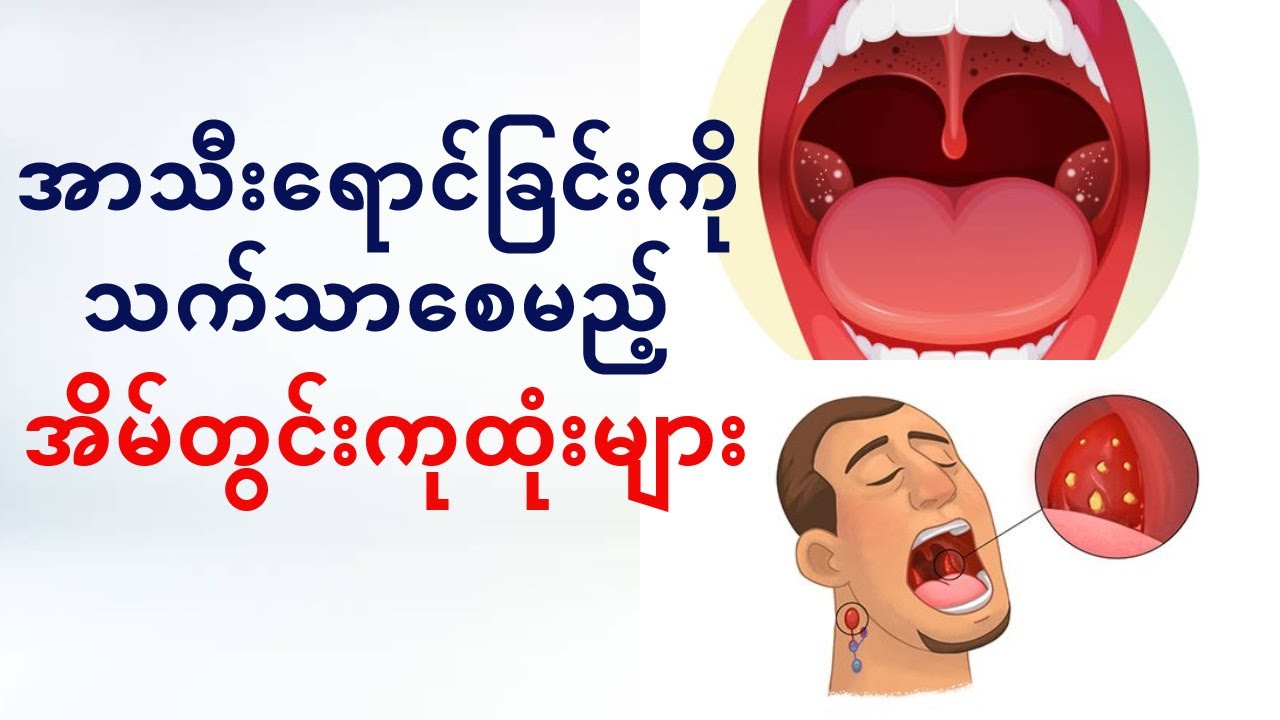 အာသီးရောင်ခြင်းကိုသက်သာစေမည့် အိမ်တွင်းနည်းလမ်းများ