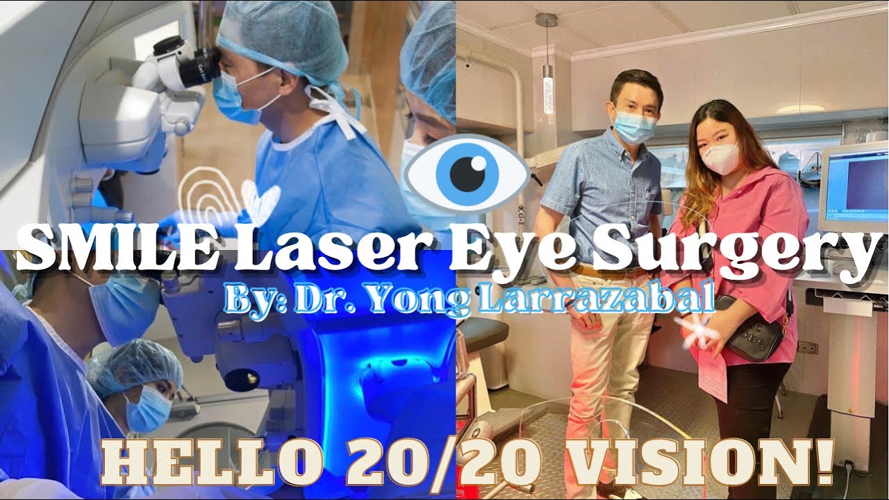 GOODBYE EYEGLASSES, HELLO 20/20 VISION 👀 MY SMILE LASER EYE SURGERY EXPERIENCE by Dr. Larrazabal