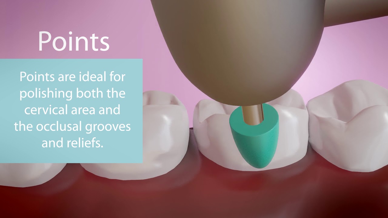 Kenda CGI: Polishers for GIC and Composite
