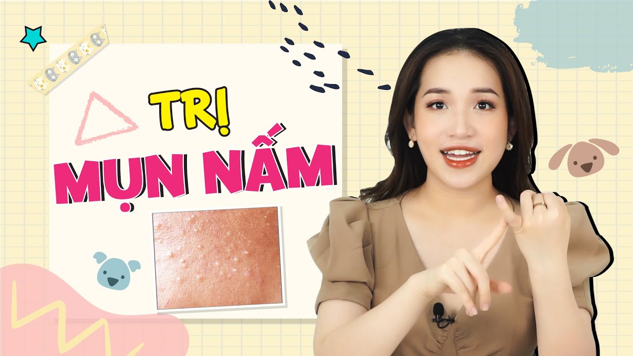 Cách Trị Mụn Nấm Trên Da Mặt - Fangal Acne