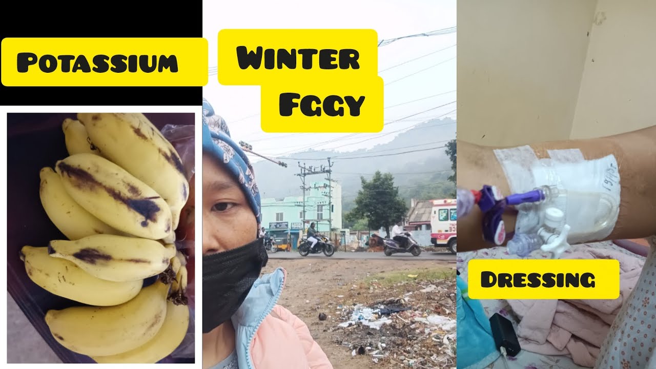 Blood, potassium all drop❤️❤️full fggy at Vellore 