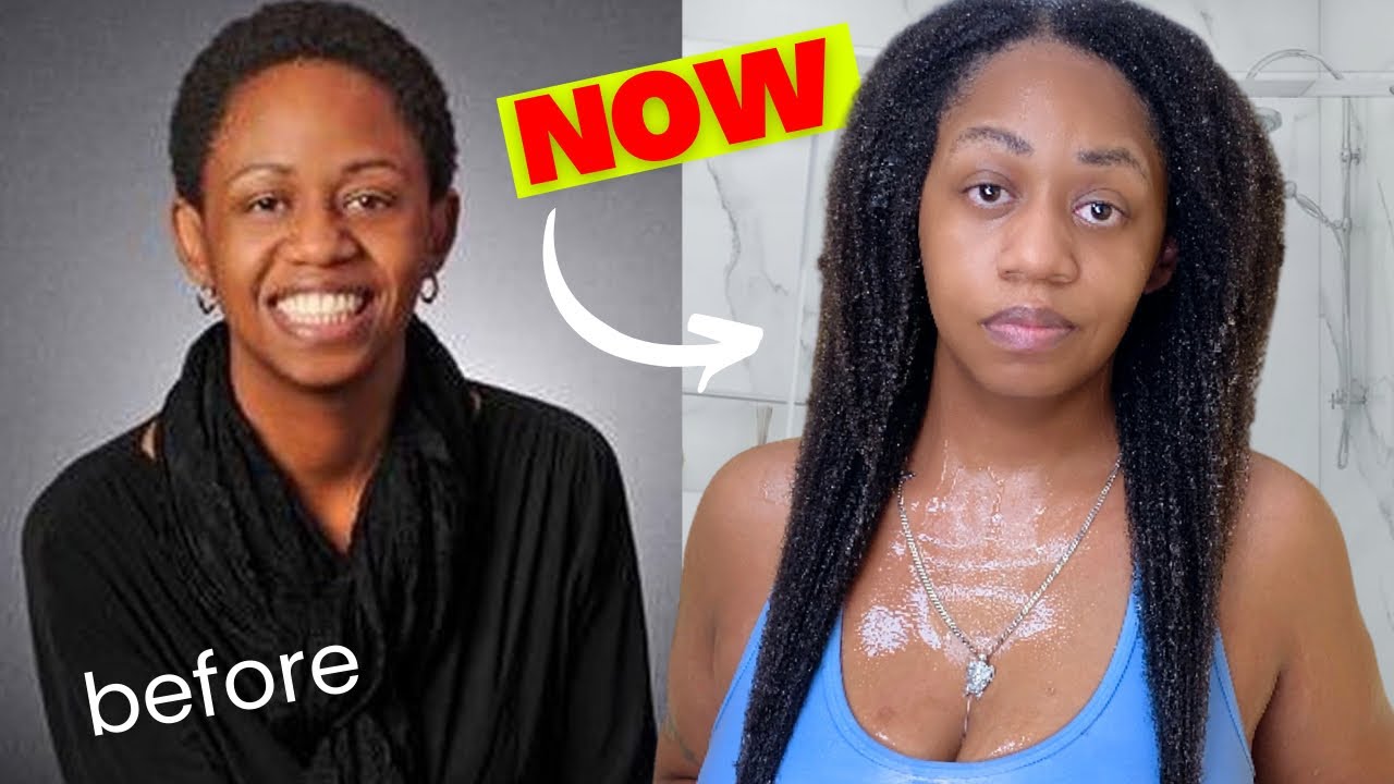 How I Grew My Hair & HEALED My Scalp... Step by Step