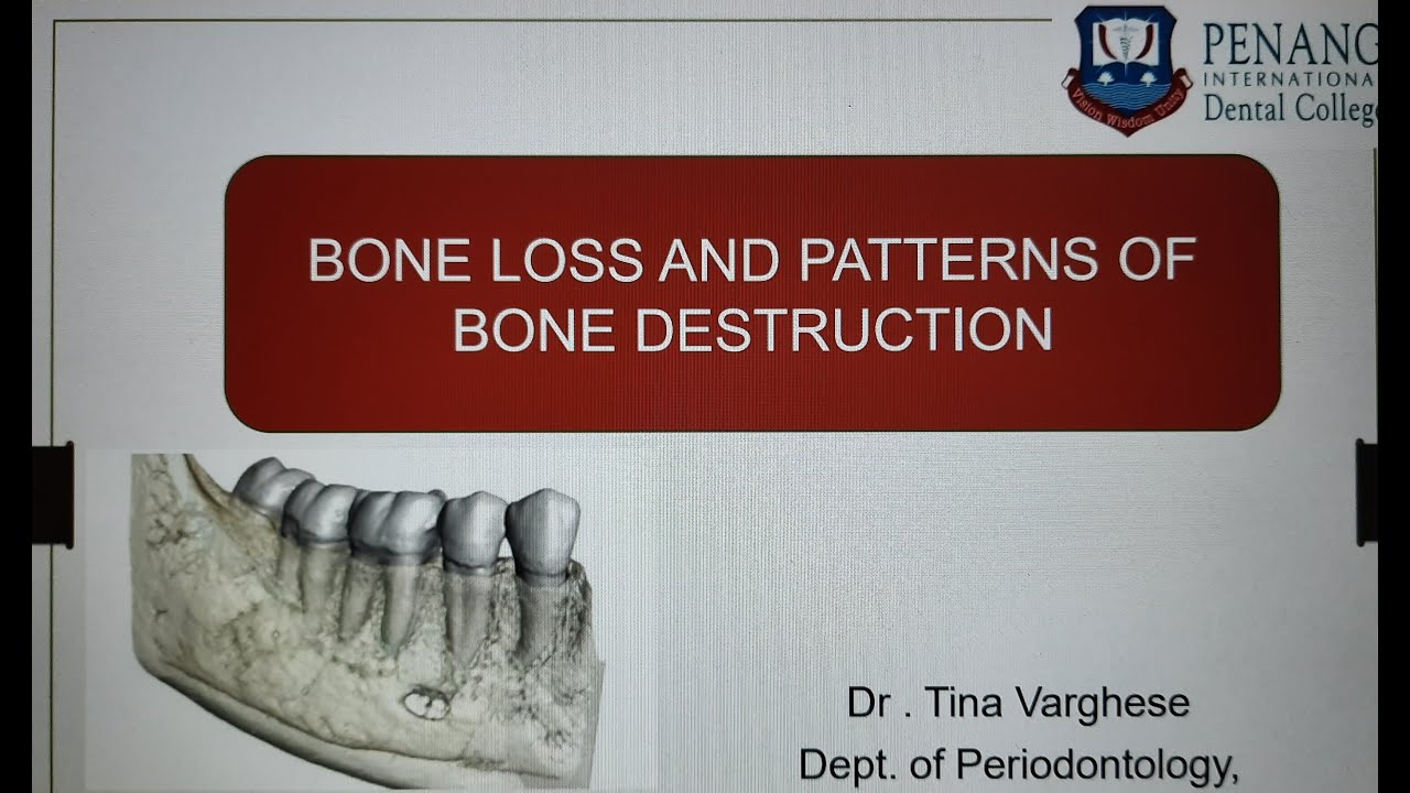 Bone Loss and Patterns of Bone Destruction