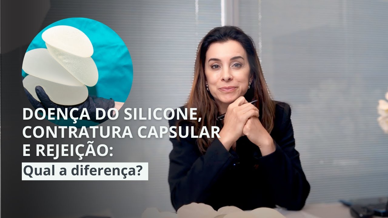 Entenda a diferença entre: Contratura capsular, rejeição e doença do silicone