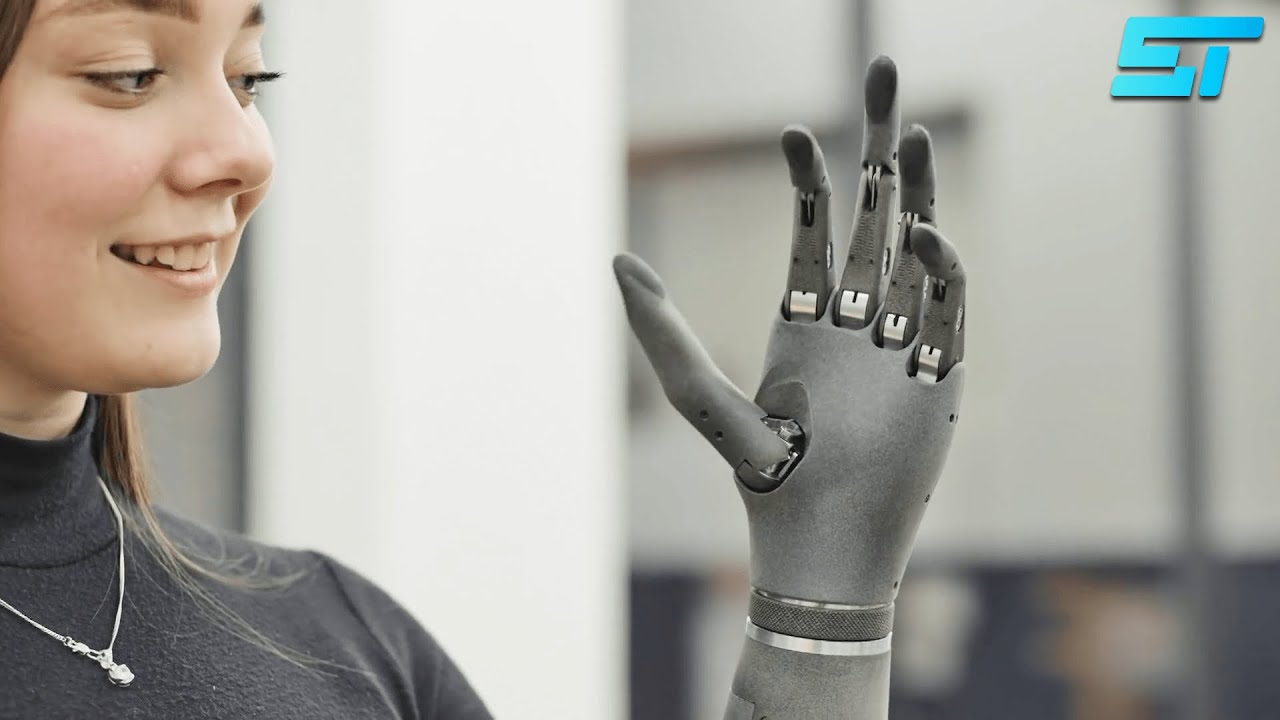 Esper Bionic Hand - A New Look On Affordable Prosthesis!