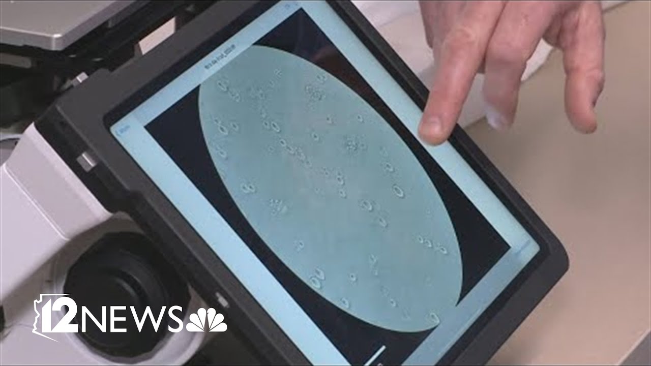 Valley Fever cases surging across Arizona
