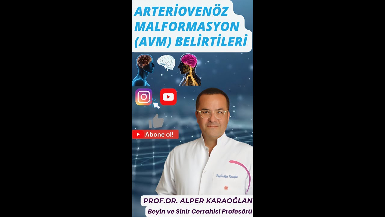 Arteriovenöz Malformasyon (AVM) (Damar Yumağı / Damar Yumaklanması) Belirtileri Nedir?