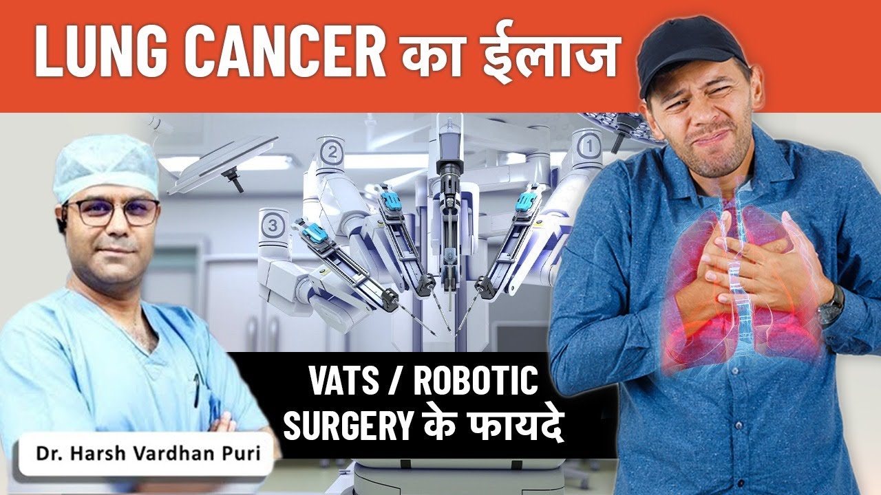 Lung Cancer Treatment | Benefits Of Robotic Surgery | Video-Assisted Thoracic Surgery (VATS) Delhi