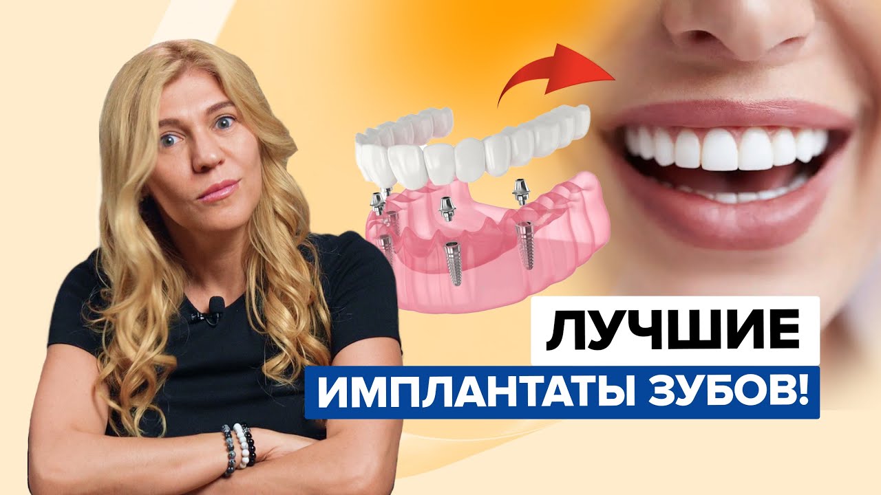 ЗУБНЫЕ ИМПЛАНТАТЫ. ТОП ЛУЧШИХ! Дешевый, средний и дорогой зубной имплант.