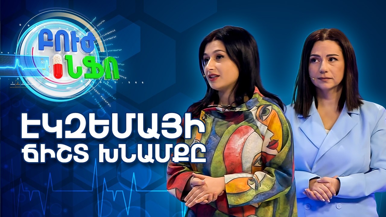 Գլխավոր|Բուժ Ինֆո/BujInfo/ Էկզեմատոզ մաշկ․ արդյո՞ք միայն խոնավեցումն է բավարար
