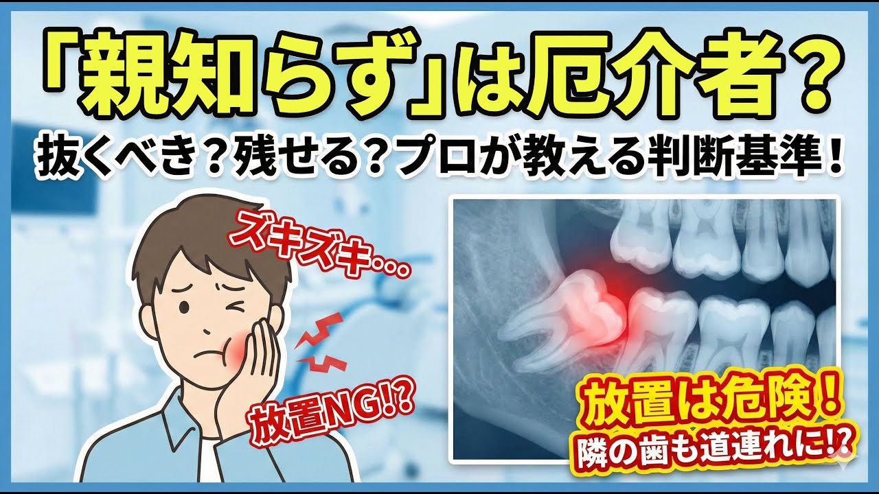 【衝撃】親知らずは厄介者？　抜くべきか？　放置すべきか？　その判断基準は？　そもそも親知らずって何？