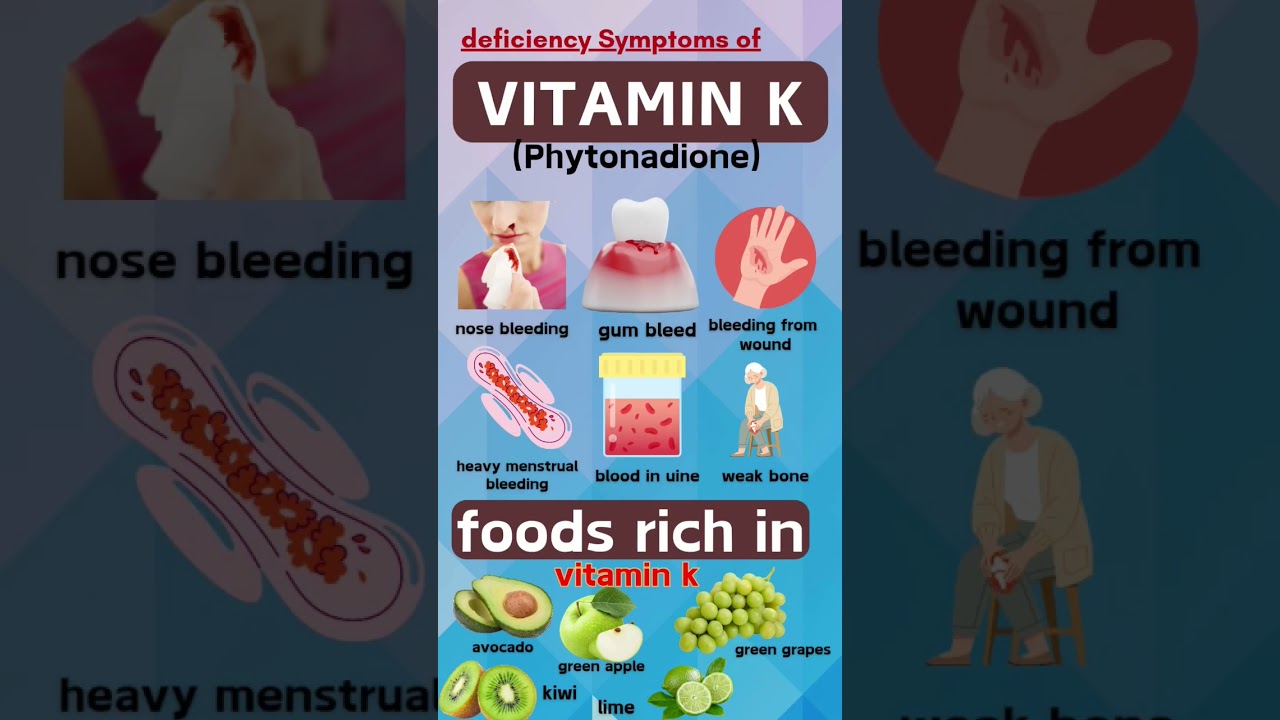 vitamin K deficiency signs and foods rich in it. #food #vitamink