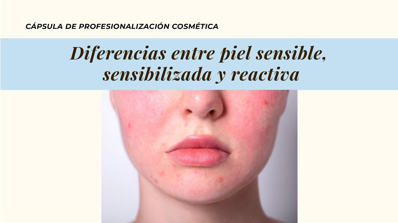 Diferencias entre piel sensible, sensibilizada y reactiva