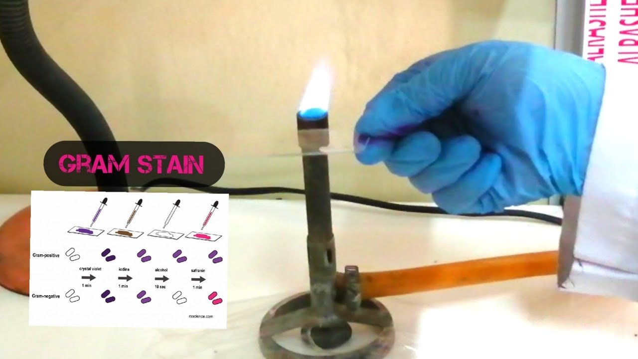 التصبيغ باستخدام صبغة غرام // Staining with Gram stain