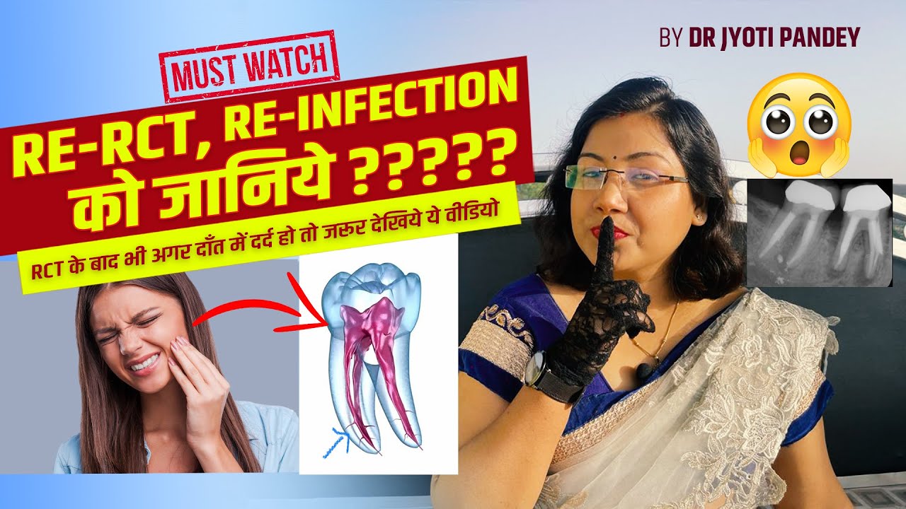 Re-RCT, Re-infection को जानिये || RCT के बाद भी अगर दाँत में दर्द हो तो जरूर देखिये ये वीडियो