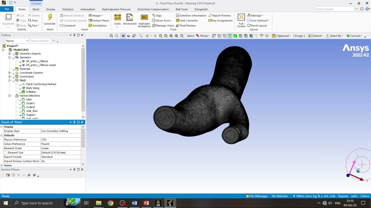 CFD-FSI-DPM Carotid Artery - [1] Geometry and Meshing