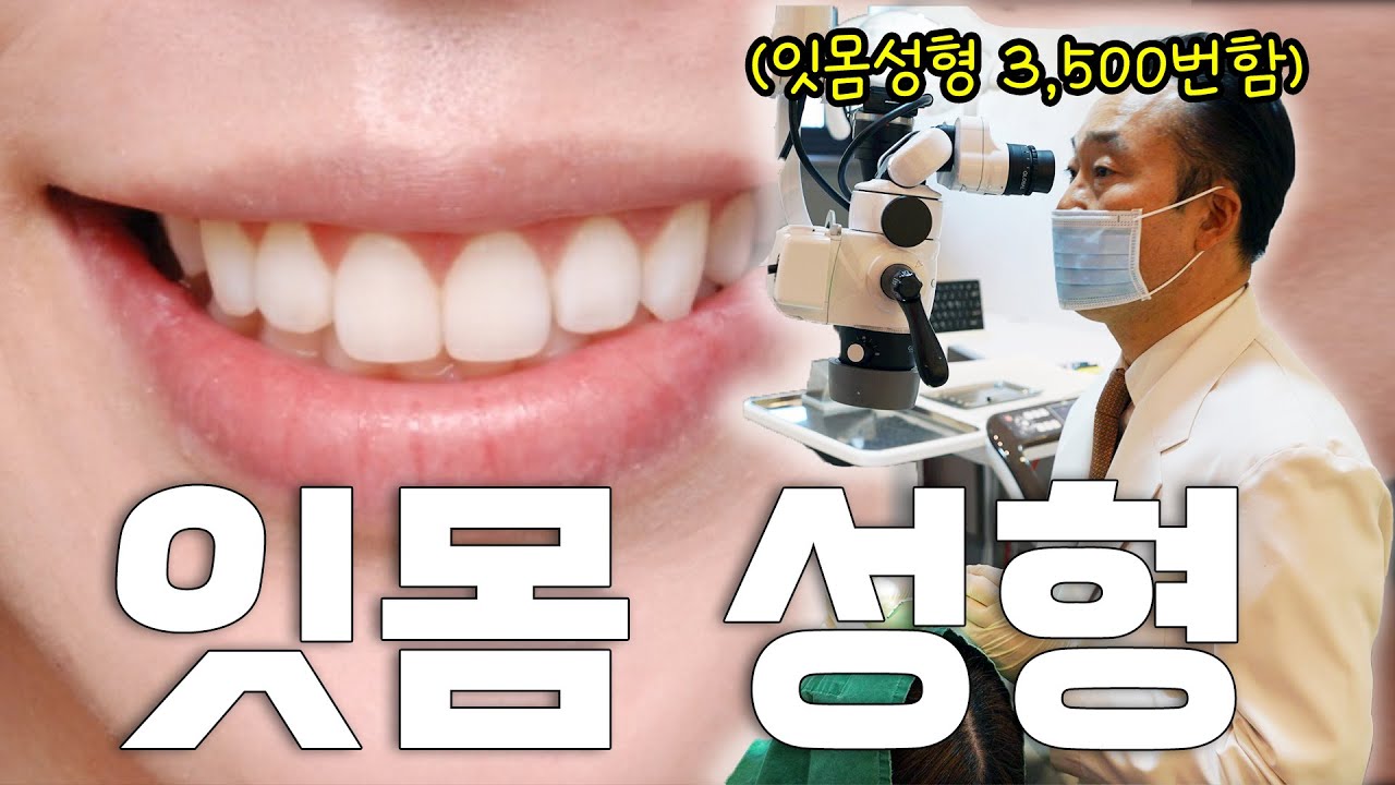 3500회 잇몸성형 케이스 경험을 통한 잇몸 성형의 모든것 - 치의학박사 서종진 대표원장